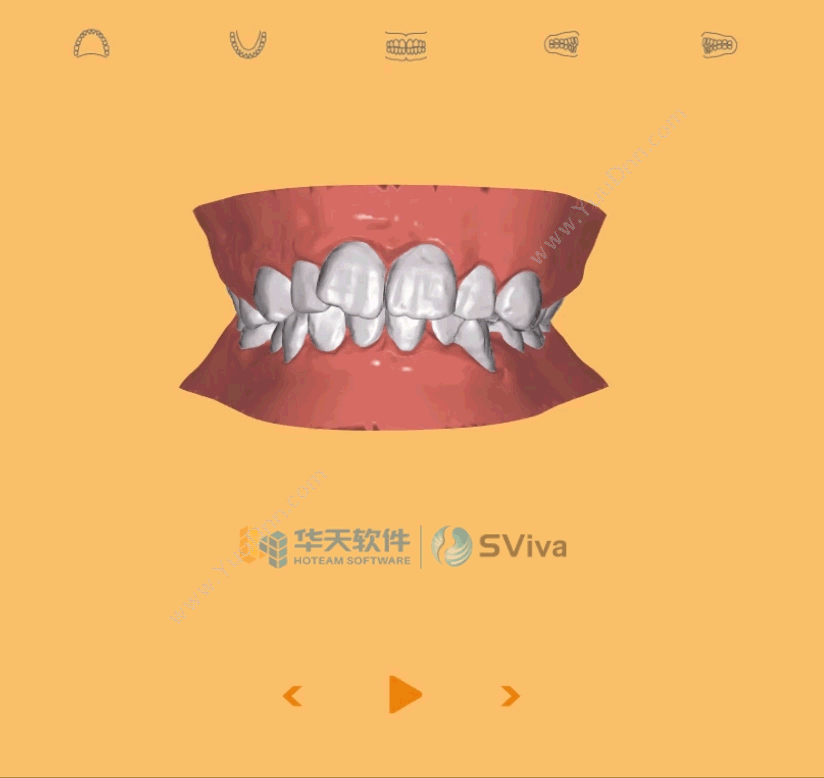 预见牙齿矫治的蜕变之美——华天软件SViva个性化正畸动画服务